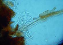 Spores of the Macrophomina phaseolina pathogen can be seen as transparent ovals in this microscopic image taken from an infected corn plant. (Photo by MSU Extension Service/ Clarissa Balbalian)